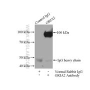 GRIA2 Rabbit Polyclonal Antibody (11994-1-AP)