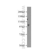 USP33 Rabbit Polyclonal Antibody (12060-2-AP)