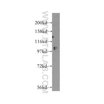 USP33 Rabbit Polyclonal Antibody (12060-2-AP)