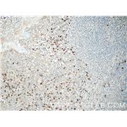 TRA- Rabbit Polyclonal Antibody (11890-1-AP)
