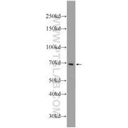 PCSK7 Rabbit Polyclonal Antibody (12044-1-AP)