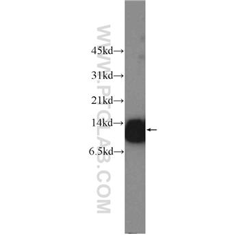DNAJC19 Rabbit Polyclonal Antibody (12096-1-AP)