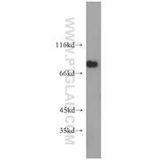 SPATA7 Rabbit Polyclonal Antibody (12020-1-AP)