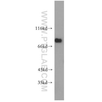 SPATA7 Rabbit Polyclonal Antibody (12020-1-AP)