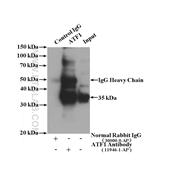 ATF1 Rabbit Polyclonal Antibody (11946-1-AP)