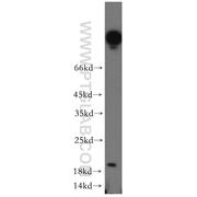UBE2G1 Rabbit Polyclonal Antibody (12012-1-AP)