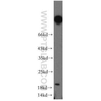UBE2G1 Rabbit Polyclonal Antibody (12012-1-AP)