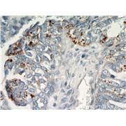 CHI3L1 Rabbit Polyclonal Antibody (12036-1-AP)
