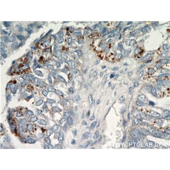 CHI3L1 Rabbit Polyclonal Antibody (12036-1-AP)