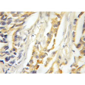 MAPKSP1 Rabbit Polyclonal Antibody (11937-1-AP)