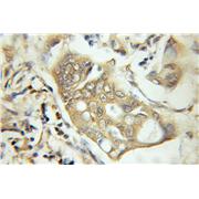 FANCA Rabbit Polyclonal Antibody (11975-1-AP)