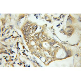 FANCA Rabbit Polyclonal Antibody (11975-1-AP)