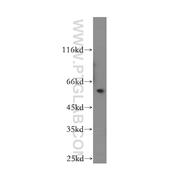 TBCE Rabbit Polyclonal Antibody (12021-1-AP)