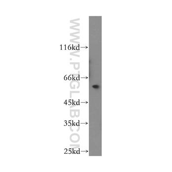 TBCE Rabbit Polyclonal Antibody (12021-1-AP)