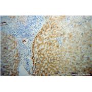 TTR Rabbit Polyclonal Antibody (11891-1-AP)