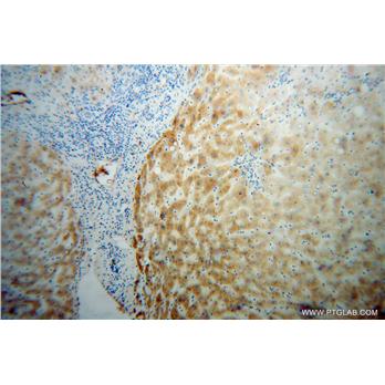 TTR Rabbit Polyclonal Antibody (11891-1-AP)