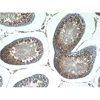 LYZL6 Rabbit Polyclonal Antibody (11922-1-AP)