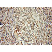 SMARCC2 Rabbit Polyclonal Antibody (12018-1-AP)