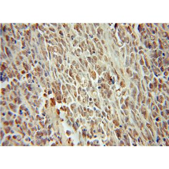 SMARCC2 Rabbit Polyclonal Antibody (12018-1-AP)