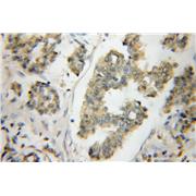 ODF2 Rabbit Polyclonal Antibody (12058-1-AP)