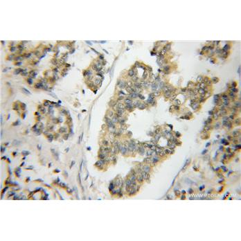ODF2 Rabbit Polyclonal Antibody (12058-1-AP)