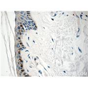 SPRR1B Rabbit Polyclonal Antibody (11959-1-AP)