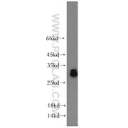 ASB9 Rabbit Polyclonal Antibody (11952-1-AP)