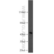 AP3M2 Rabbit Polyclonal Antibody (11925-1-AP)