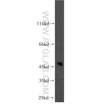 AP3M2 Rabbit Polyclonal Antibody (11925-1-AP)