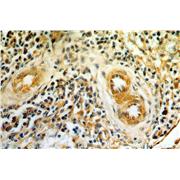 AGGF1 Rabbit Polyclonal Antibody (11889-1-AP)