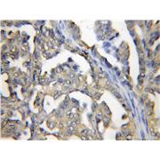 PRTFDC1 Rabbit Polyclonal Antibody (11986-1-AP)