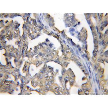 PRTFDC1 Rabbit Polyclonal Antibody (11986-1-AP)