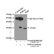 PSMA4 Rabbit Polyclonal Antibody (11943-2-AP)