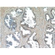 PAGE2 Rabbit Polyclonal Antibody (11961-1-AP)