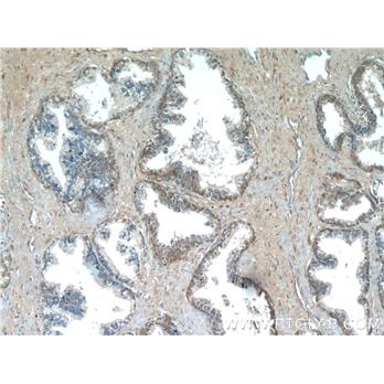 PAGE2 Rabbit Polyclonal Antibody (11961-1-AP)