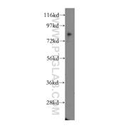 CD164 Rabbit Polyclonal Antibody (12083-2-AP)