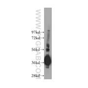 GNB4 Rabbit Polyclonal Antibody (11978-2-AP)
