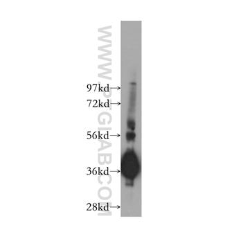 GNB4 Rabbit Polyclonal Antibody (11978-2-AP)