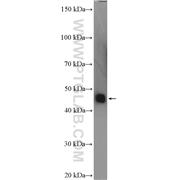 SERPINA6 Rabbit Polyclonal Antibody (12010-1-AP)