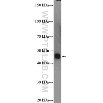 SERPINA6 Rabbit Polyclonal Antibody (12010-1-AP)
