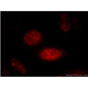 AGFG2 Rabbit Polyclonal Antibody (11919-1-AP)