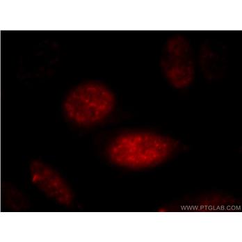 AGFG2 Rabbit Polyclonal Antibody (11919-1-AP)
