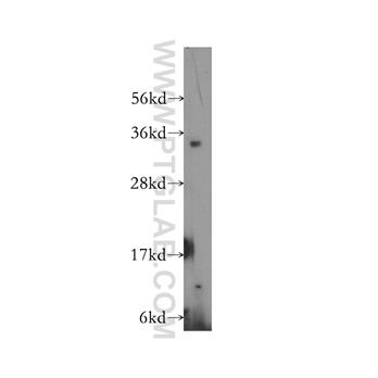 PSMD14 Rabbit Polyclonal Antibody (12059-1-AP)