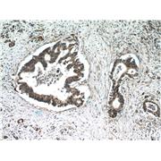 TMED2 Rabbit Polyclonal Antibody (11981-1-AP)
