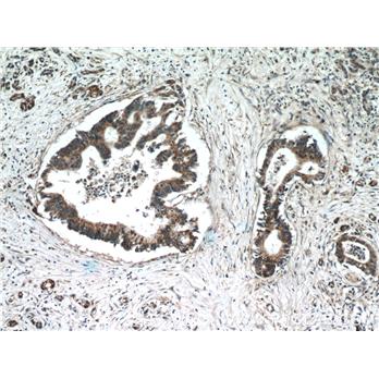 TMED2 Rabbit Polyclonal Antibody (11981-1-AP)