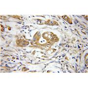 PSMD3 Rabbit Polyclonal Antibody (12054-1-AP)