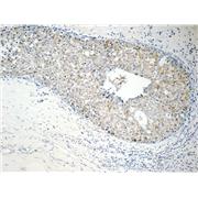 RABL3 Rabbit Polyclonal Antibody (11916-1-AP)