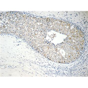 RABL3 Rabbit Polyclonal Antibody (11916-1-AP)