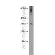 DOK5 Rabbit Polyclonal Antibody (11948-1-AP)
