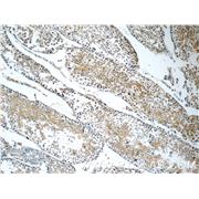 FXYD4 Rabbit Polyclonal Antibody (11966-1-AP)